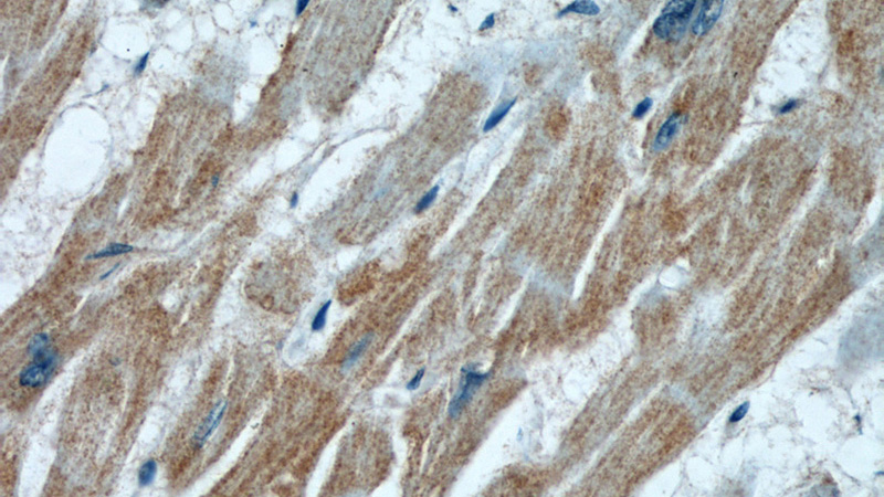 Immunohistochemical of paraffin-embedded human heart using Catalog No:116782(PIK3C3 antibody) at dilution of 1:50 (under 40x lens)
