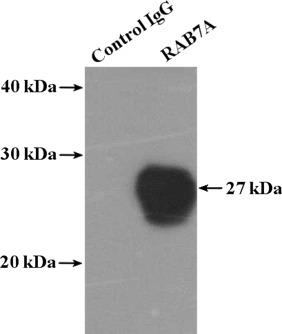 IP Result of anti-RAB7A (IP:Catalog No:114458, 4ug; Detection:Catalog No:114458 1:300) with SH-SY5Y cells lysate 1600ug.