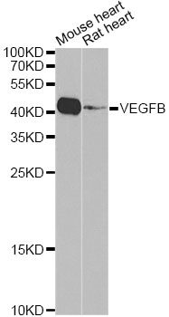 Western blot - VEGFB Polyclonal Antibody 