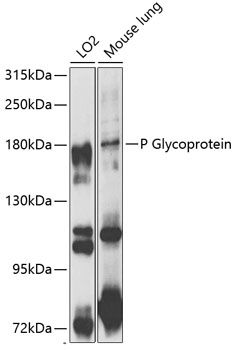 Western blot - P Glycoprotein Polyclonal Antibody 