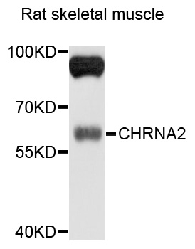 Western blot - CHRNA2 Polyclonal Antibody 