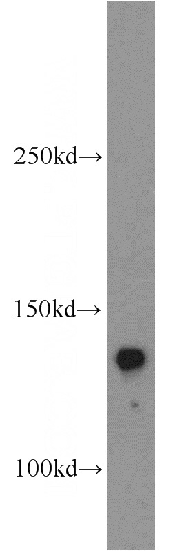 mouse lung tissue were subjected to SDS PAGE followed by western blot with Catalog No:116123(TEK antibody) at dilution of 1:500