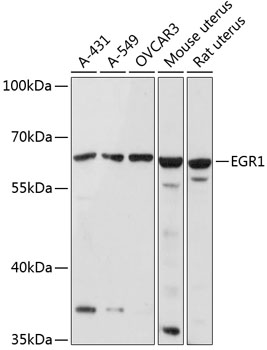 Western blot - EGR1 Polyclonal Antibody 