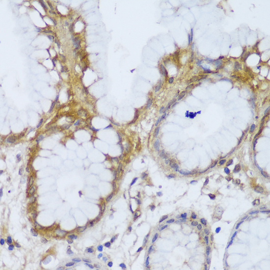 Immunohistochemistry - GCC2 Polyclonal Antibody 