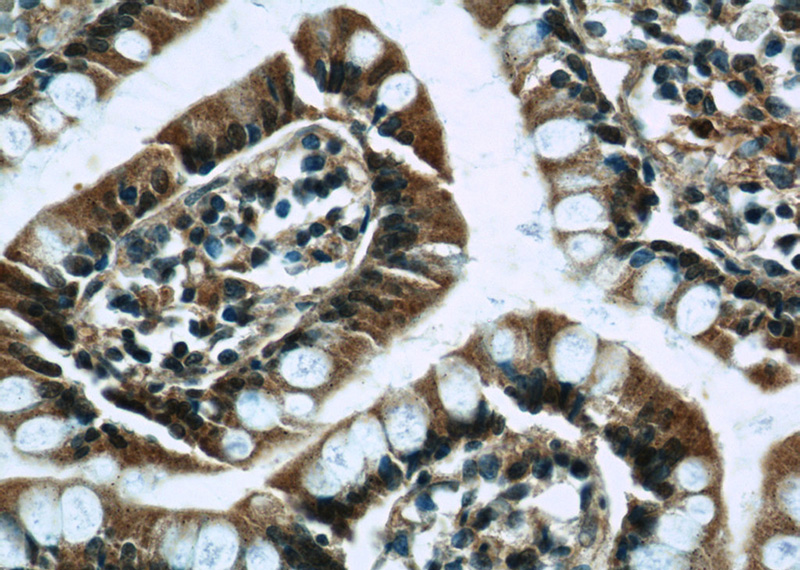 Immunohistochemistry of paraffin-embedded human small intestine tissue slide using Catalog No:111981(KIAA0430 Antibody) at dilution of 1:50 (under 40x lens)