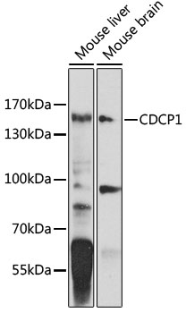 Western blot - CDCP1 Polyclonal Antibody 