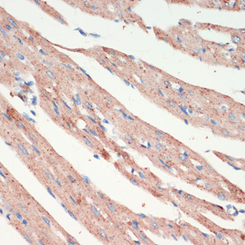 Immunohistochemistry - LRRK2 Polyclonal Antibody 
