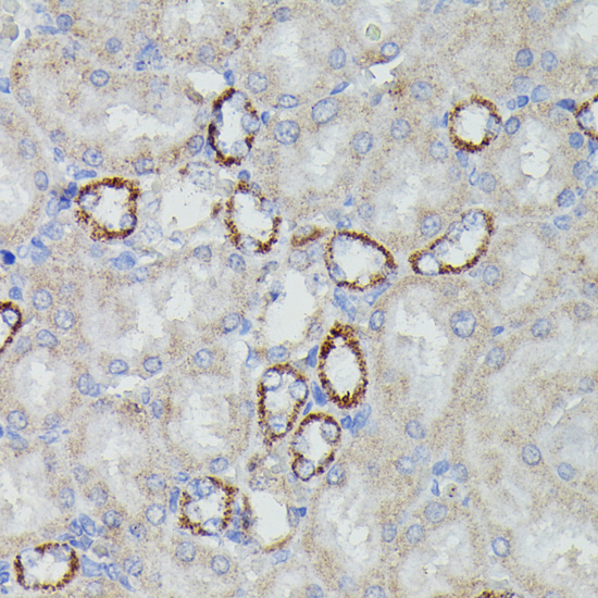 Immunohistochemistry - NDUFAB1 Polyclonal Antibody 