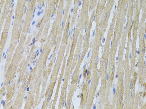 Immunohistochemistry - P2RY2 Polyclonal Antibody 
