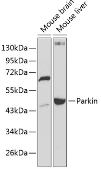 Western blot - Parkin Polyclonal Antibody 