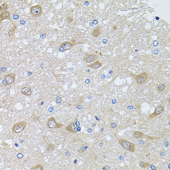 Immunohistochemistry - AKAP5 Polyclonal Antibody 