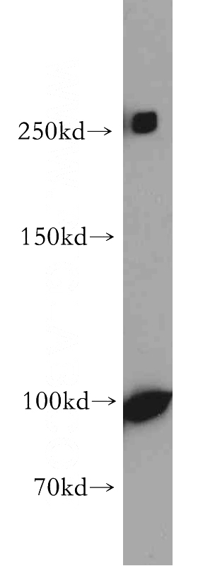 COLO 320 cells were subjected to SDS PAGE followed by western blot with Catalog No:113309(NOTCH3 antibody) at dilution of 1:500