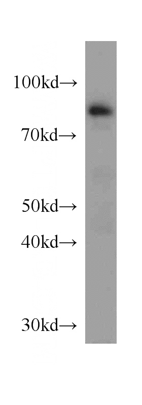 mouse thymus tissue were subjected to SDS PAGE followed by western blot with Catalog No:110211(EFS antibody) at dilution of 1:300