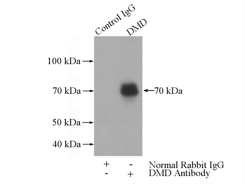 IP Result of anti-DMD (IP:Catalog No:110149, 4ug; Detection:Catalog No:110149 1:1500) with mouse brain tissue lysate 3440ug.