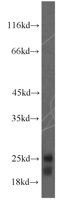 mouse brain tissue were subjected to SDS PAGE followed by western blot with Catalog No:110630(FGF12 antibody) at dilution of 1:1000