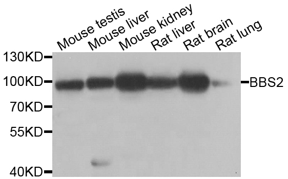 Western blot - BBS2 Polyclonal Antibody 