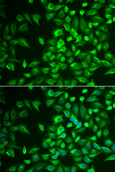 Immunofluorescence - LRAT Polyclonal Antibody 