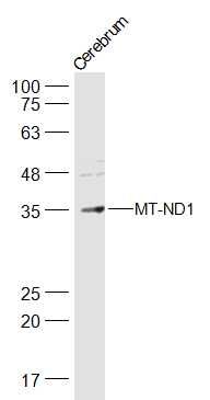 Fig1: Sample:; Cerebrum (Rat) Lysate at 40 ug; Primary: Anti-MT-ND1 at 1/500 dilution; Secondary: IRDye800CW Goat Anti-Rabbit IgG at 1/20000 dilution; Predicted band size: 36 kD; Observed band size: 35 kD