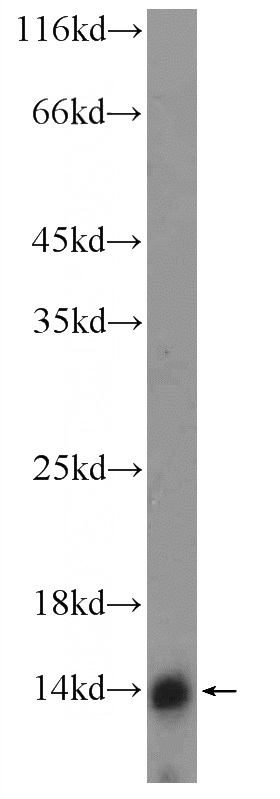 mouse spleen tissue were subjected to SDS PAGE followed by western blot with Catalog No:112398(LY6D Antibody) at dilution of 1:300