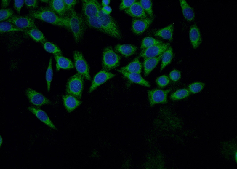 Immunofluorescent analysis of HeLa cells using Catalog No:109920(DHPS Antibody) at dilution of 1:50 and Alexa Fluor 488-congugated AffiniPure Goat Anti-Rabbit IgG(H+L)