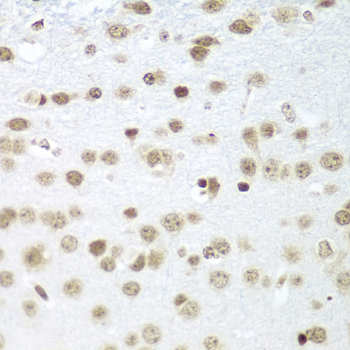 Immunohistochemistry - SAP18 Polyclonal Antibody 