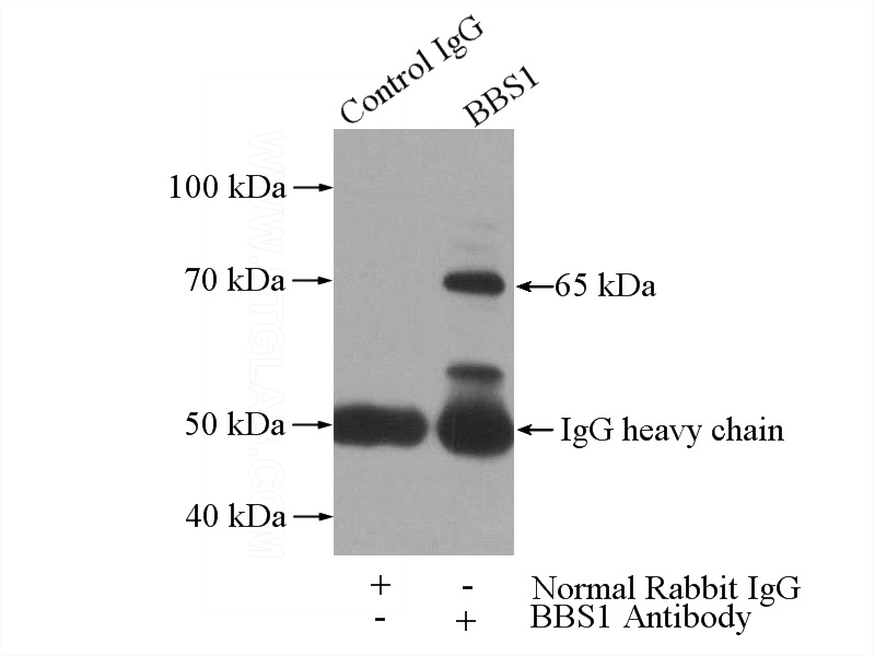 IP Result of anti-BBS1 (IP:Catalog No:108367, 4ug; Detection:Catalog No:108367 1:600) with mouse brain tissue lysate 4000ug.