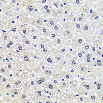 Immunohistochemistry - CCDC59 Polyclonal Antibody 