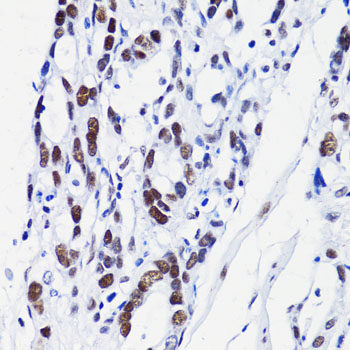 Immunohistochemistry - Acetyl-Histone H2B-K15 pAb 