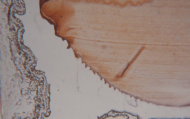 Immunohistochemical of paraffin-embedded human eye using Catalog No:107868(CRYAB antibody) at dilution of 1:100 (under 10x lens)