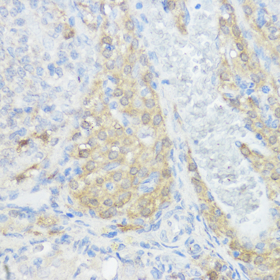 Immunohistochemistry - NOD1 Polyclonal Antibody 