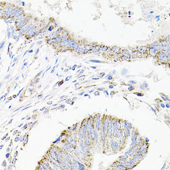 Immunohistochemistry - SDC2 Polyclonal Antibody 