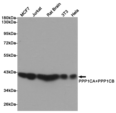 Western blot analysis of extracts from MCF7, Jurkat, Rat Brain, 3T3 and Hela cells using PPP1CA+PPP1CB Rabbit pAb at 1:1000 dilution. Predicted band size: 37kDa. Observed band size: 37kDa.
