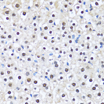 Immunohistochemistry - CCAR2 Polyclonal Antibody 