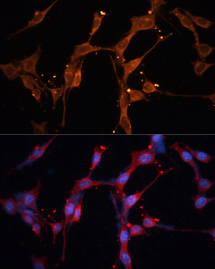 Immunofluorescence - LPL Polyclonal Antibody 