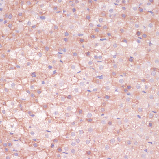 Immunohistochemistry - CYP11B2 Polyclonal Antibody 