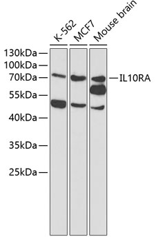 Western blot - IL10RA Polyclonal Antibody 