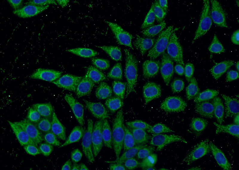 Immunofluorescent analysis of HeLa cells using Catalog No:112087(KLHDC5 Antibody) at dilution of 1:50 and Alexa Fluor 488-congugated AffiniPure Goat Anti-Rabbit IgG(H+L)