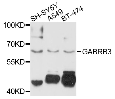 Western blot - GABRB3 Polyclonal Antibody 