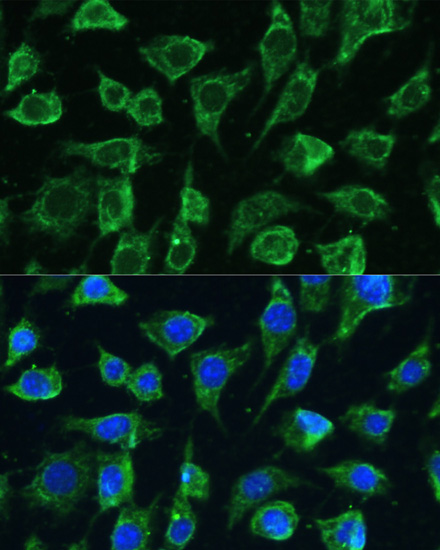 Immunofluorescence - PTPN22 Polyclonal Antibody 