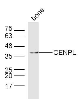 Fig3: Sample: bone (Mouse) Lysate at 40 ug; Primary: Anti-CENPL at 1/300 dilution; Secondary: IRDye800CW Goat Anti-Rabbit IgG at 1/20000 dilution; Predicted band size: 39 kD; Observed band size: 39 kD