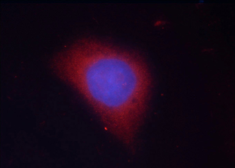 Immunofluorescent analysis of Ethacrynic acid treated HeLa cells using Catalog No:111170(GSK3B Antibody) at dilution of 1:25 and Rhodamine-Goat anti-Rabbit IgG