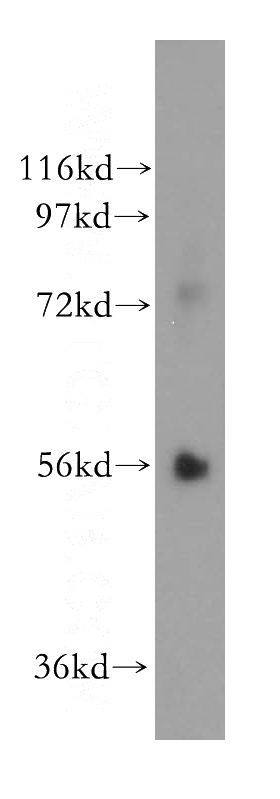 human stomach tissue were subjected to SDS PAGE followed by western blot with Catalog No:114086(PPAT antibody) at dilution of 1:500