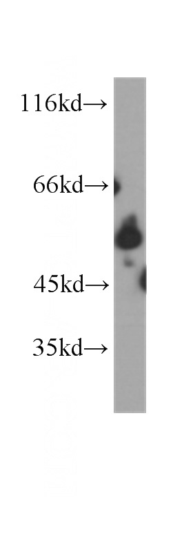 Jurkat cells were subjected to SDS PAGE followed by western blot with Catalog No:107374(LCK antibody) at dilution of 1:1000