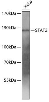 Western blot - STAT2 Polyclonal Antibody 