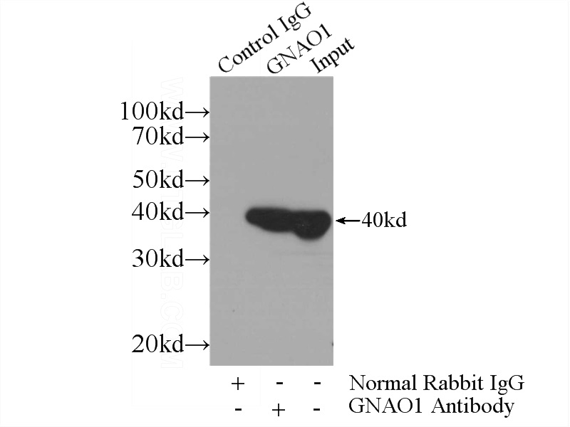 IP Result of anti-GNAO1 (IP:Catalog No:110990, 3ug; Detection:Catalog No:110990 1:600) with mouse brain tissue lysate 3600ug.