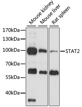 Western blot - STAT2 Polyclonal Antibody 