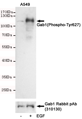 Western blot detection of Gab1(Phospho-Tyr627) in A549 cells untreated or treated with EGF using Gab1(Phospho-Tyr627) Rabbit pAb (dilution 1:500, upper) or Gab1 Rabbit pAb (310130, dilution 1:1000, lower).Predicted band size:110kDa.Observed band size:110kDa.