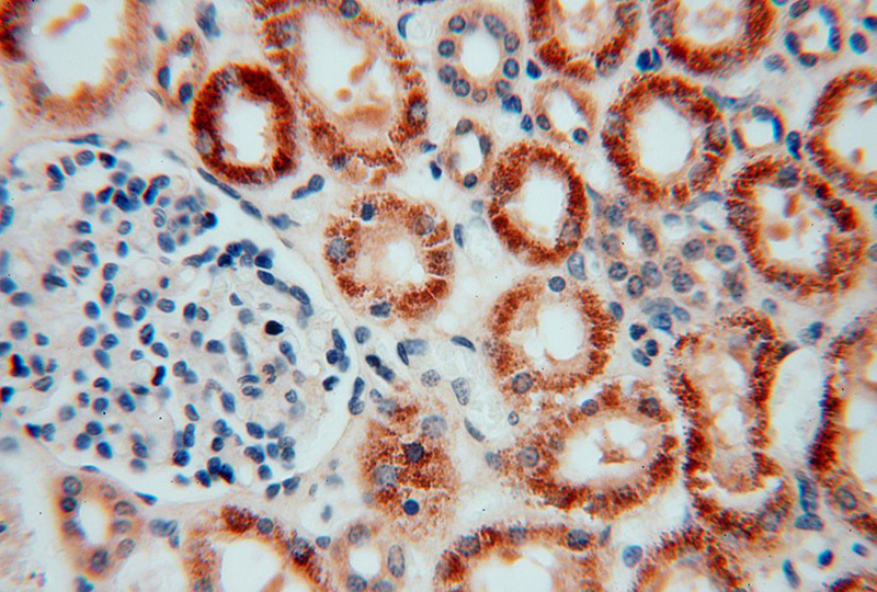 Immunohistochemical of paraffin-embedded human kidney using Catalog No:110299(EDC3 antibody) at dilution of 1:50 (under 40x lens)