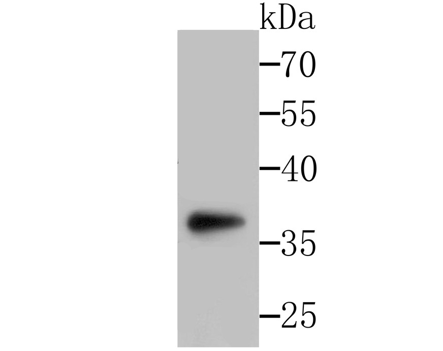 Fig1: Western blot analysis of SFRP1 on SH-SY-5Y cells lysates using anti-SFRP1 antibody at 1/500 dilution.