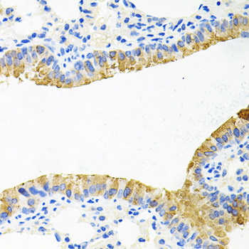 Immunohistochemistry - TOB2 Polyclonal Antibody 